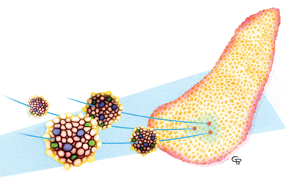 An illustration of islet cells in the forefront, with a pancreas in the background